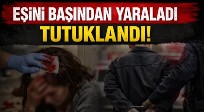 Eşini Başından Yaraladı, Tutuklandı
